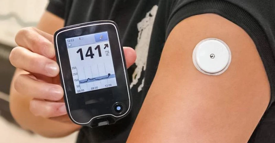 Continuous Glucose Monitor